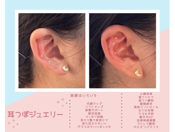 丸太町骨盤整骨院 鍼灸院/耳つぼジュエリー