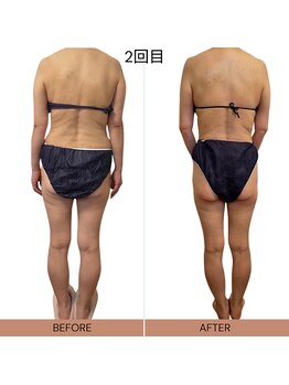 ママニエ(ma maniere)/全身痩身2回コース終了のお客様