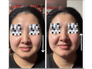 ローリエ/リフトアップ！