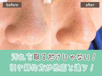 キザシ(kizashi)/最新毛穴ケア☆即実感！毛穴縮小