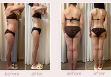 フォルスボーテ(Force Beaute)