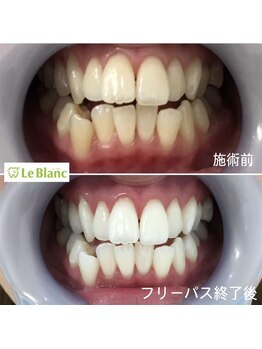 ルブラン 奈良店(Le Blanc)/学生のお客様も多いです♪