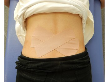 りらく整体 あおば/テーピング2