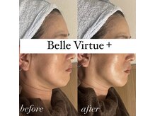 ベルバーチュプラス(Belle Virtue +)/カーボキシー