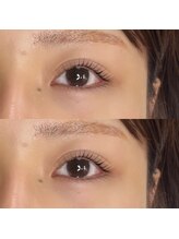 フィービー(pheebe)/まつげパーマ