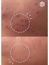 ビジュープラス ひたち野うしく店(Bijou+)/