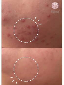 ビジュープラス ひたち野うしく店(Bijou+)/