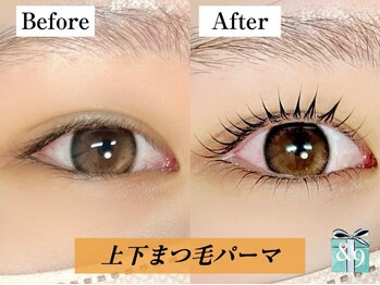 アンドナイン(AND NINE)の写真/《逆まつげ改善★まつげパーマ上下》100種類以上のロッドを駆使し、理想の目元を実現♪ぱっちりまつげに◎