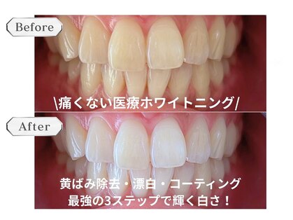 ホワイトニングビューティー 市川妙典店の写真