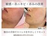 【人気No1】赤み劇的改善★敏感肌に優しいハーブ 75分 毛穴洗浄付き