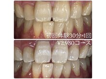 ホワイトニングルーム 横浜店(Whitening Room)/ホワイトニング/横浜