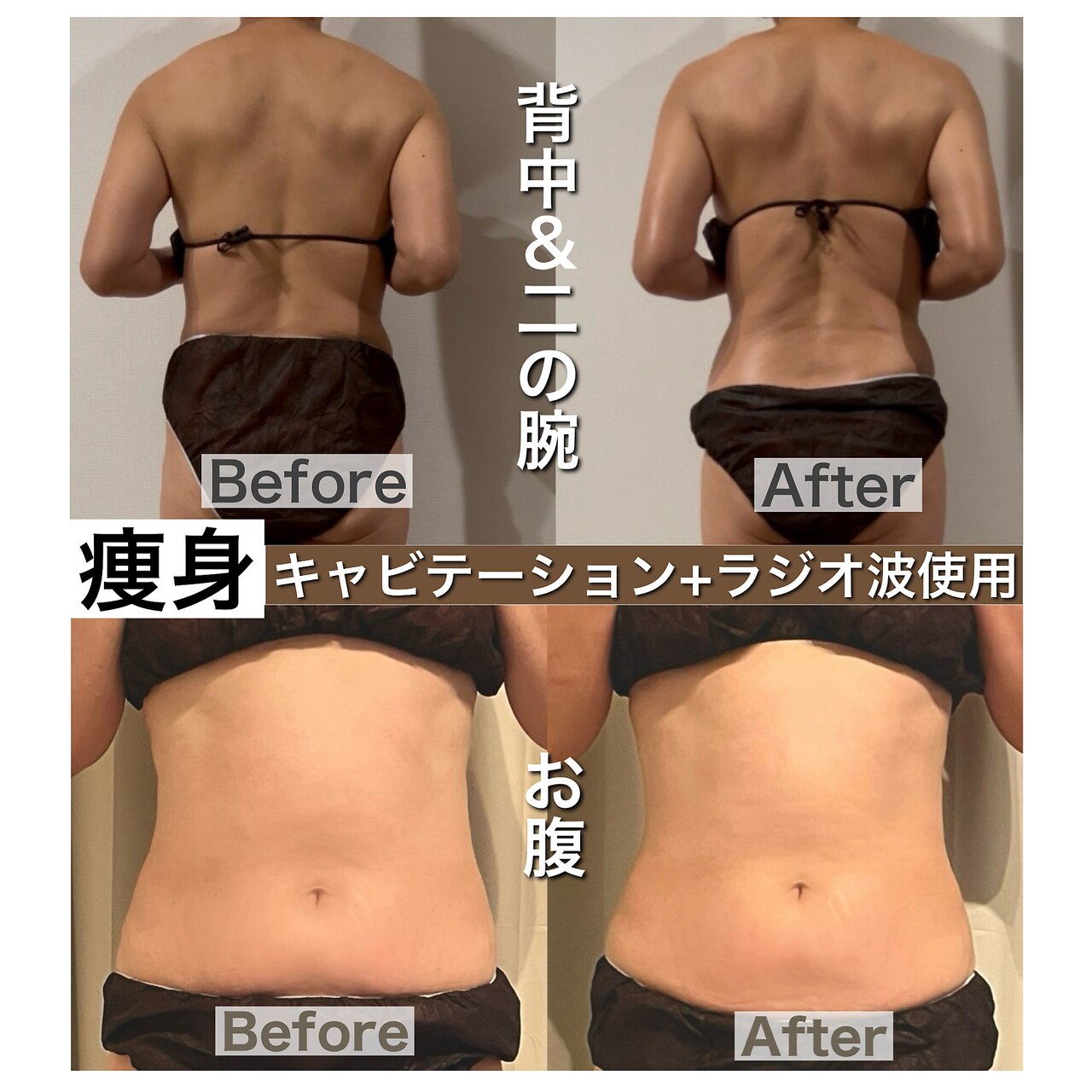 大阪市住吉区でキャビテーションが人気のエステサロン