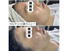 レイ(Rey)/1時間で小顔艶玉肌へ/小顔コルギ