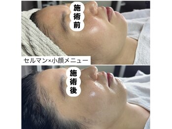 レイ(Rey)/1時間で小顔艶玉肌へ/小顔コルギ