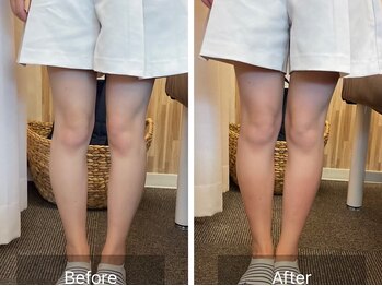 ナオル整体 札幌院(NAORU整体)/札幌円山/整体/O脚