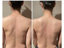 小顔フェイスラボ 袋井店(小顔FaceLabo.)/【実際の変化】小顔&整体コルギ