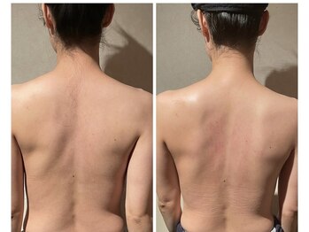 小顔フェイスラボ 袋井店(小顔FaceLabo.)/【実際の変化】小顔&整体コルギ