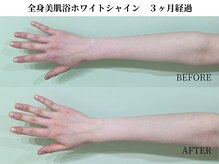 サンビ(SANBI)/血流UPでトーンUPが叶う♪