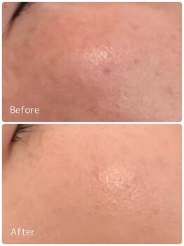 ククル(KUKULU)/ハーブ6回目♪(40代女性)