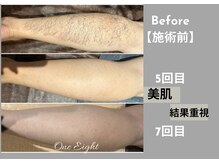 ワンエイト(One Eight)