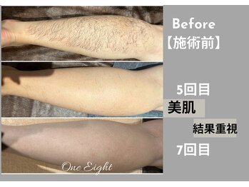 ワンエイト(One Eight)