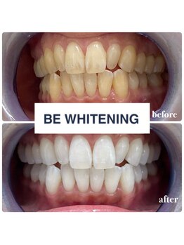 ビーホワイト 名古屋金山店(BE WHITE)/特別なイベントが近い方は♪