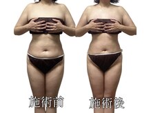 エリクシア 松戸/40代リンパケア施術例