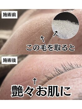 リアン(LIAN)の写真/メイクノリ悪い。なんか肌がくすんでる。そのお悩み解決できます！ツルツルお肌を即実感！