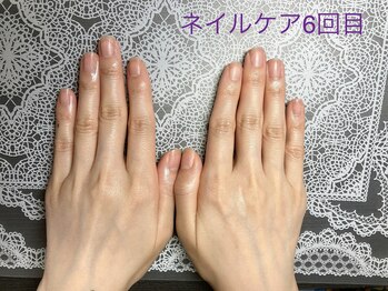 桃の木 吉祥寺店/自爪育成ネイルケア★6回施術後