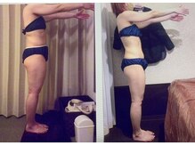 パーフェクトボディプレミアム 札幌大通店(PERFECT BODY PREMIUM)/お客様　ビフォーアフター（7）