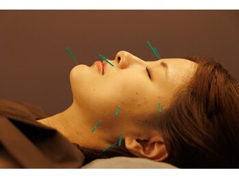 つぼぜん/【美容鍼で美肌】