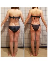 フェリシテ(Felicite)/ビフォーアフター