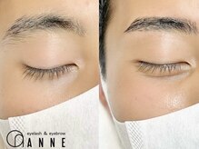 アンネ 表参道(ANNE)/ブロウリフト