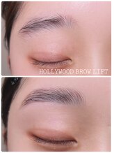 ヨリソイ(yorisoi)/HBL