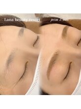 ラナビューティリゾート(Lana Beauty resort)/