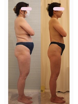 ファニービー 茨木本店/Before→After