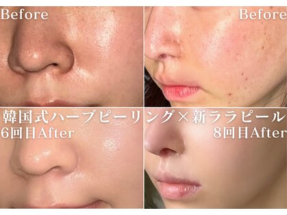 ミニョスキンラボの写真
