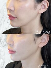 ルミライ(Lumirai)/月１の美容習慣に最適