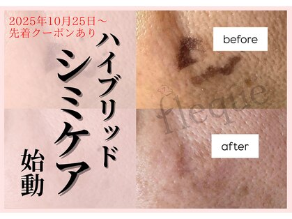 フレク(fleque)の写真