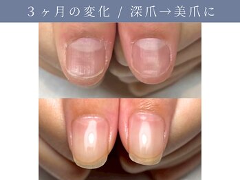 イデアル(ide’al)/理想の指先へ、確かな変化を