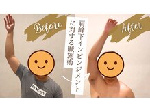 エヌアンドエヌ鍼灸院 福住店(N&えぬ鍼灸院)/鍼灸・整体　Before & After