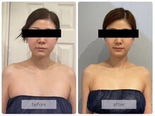 リバース(Rebirth)/綺麗になるお手伝いします♪