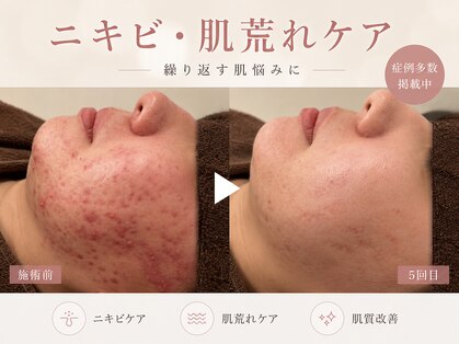 サロン ムスブ(salon MUSUBU)の写真