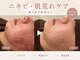 サロン ムスブ(salon MUSUBU)の写真