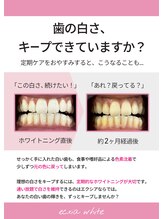 エクシアホワイトニング 阪急洛西口駅前店/白さをキープ