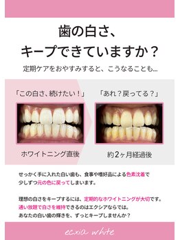 エクシアホワイトニング 阪急洛西口駅前店/白さをキープ