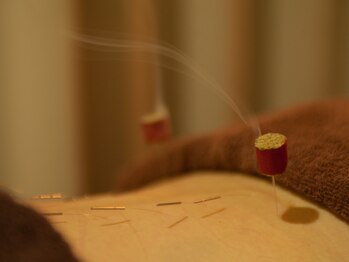 皇漢堂鍼灸療院の写真/女性鍼灸師による本格的な鍼灸で肩こり・腰痛・冷えをケア!東洋の鍼とお灸でじんわり温かリラックス♪