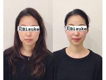 美助(bisuke)/小顔施術のお写真