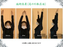 ボディ リセット アンド デザイン(Body Reset & Design)/【施術例】ビフォーアフター