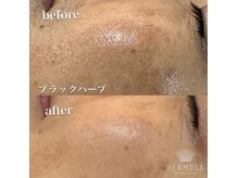 アユート(aiuto)の雰囲気（乾燥・シミ・シワ・たるみなどのケアは、気付いた時が始め時☆）